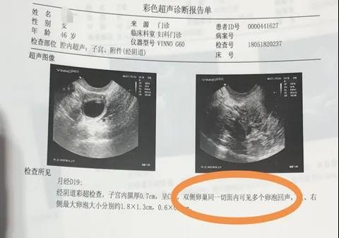 △治疗后彩色超声诊断报告单