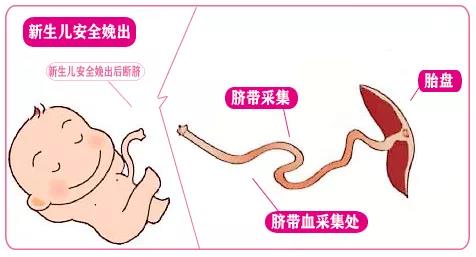 新生儿胎盘干细胞储存费用是多少？