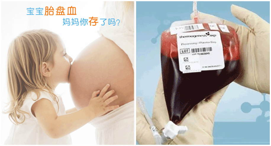脐带血干细胞正规储存机构哪里有？