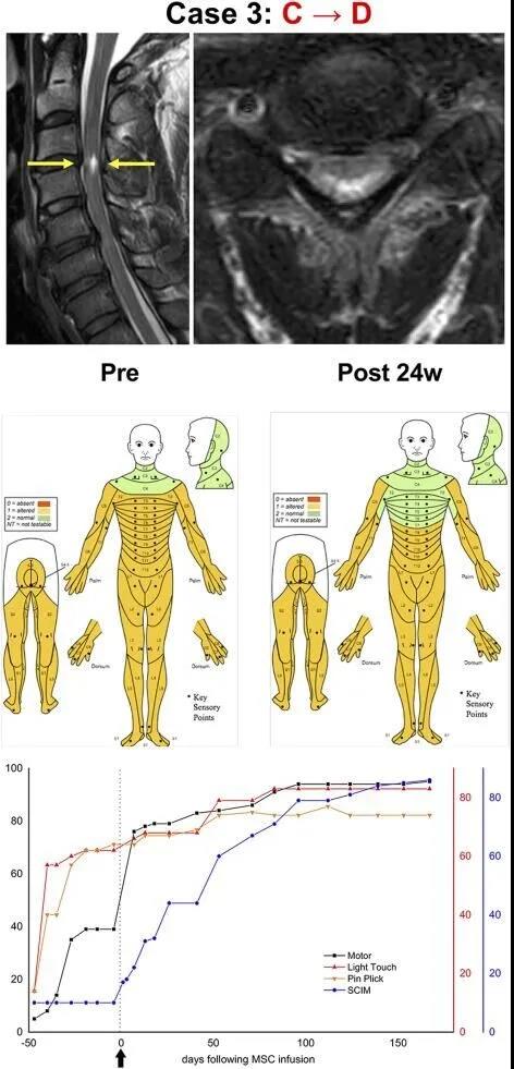 患者重获独立自主生活的能力